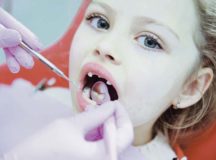 Treating pediatric dental patients with special health care needs