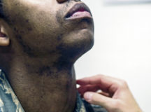 Air Force Surgeon General authorizes 5-year shaving waivers